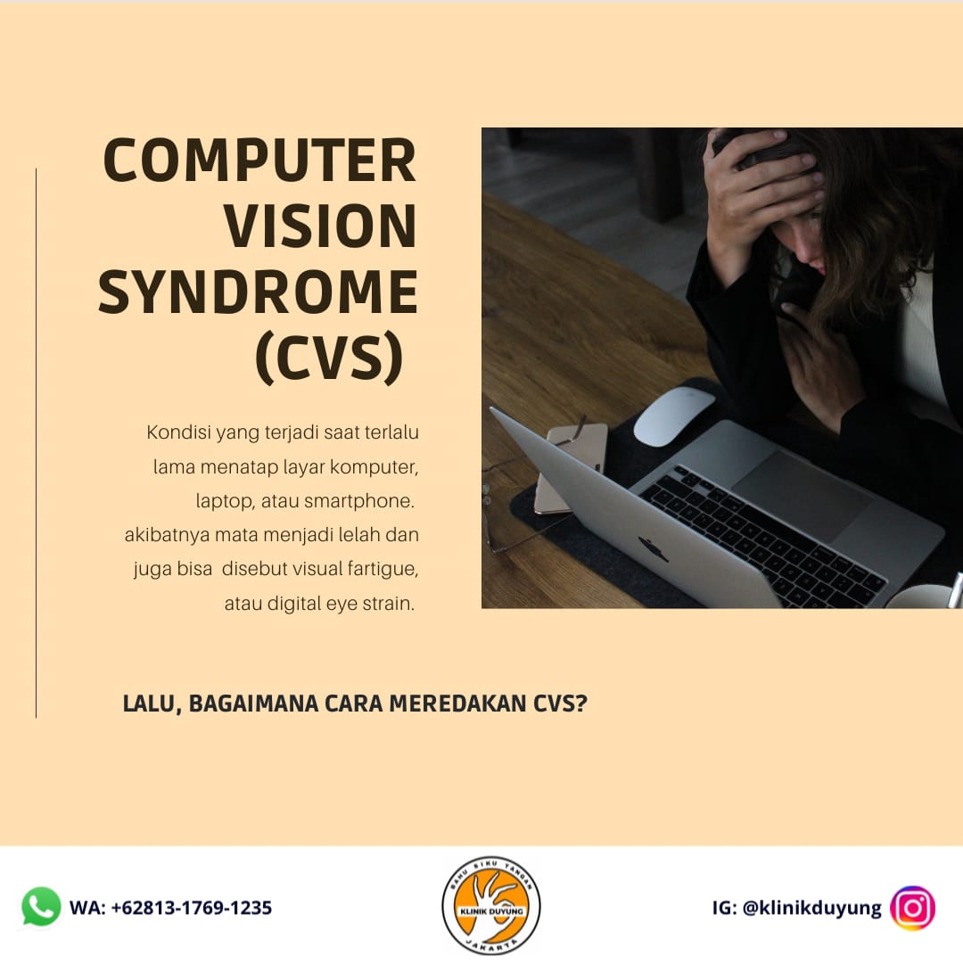 Computer Vision Syndrome (CVS)